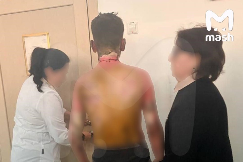 Восьмиклассница в Красноярске подожгла сверстника бензином