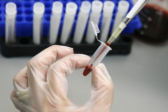 В Хакасии с начала года выявлено 17 новых случаев ВИЧ