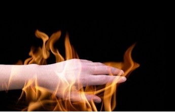 На разрезе "Аршановский" рабочий получил серьезные ожоги