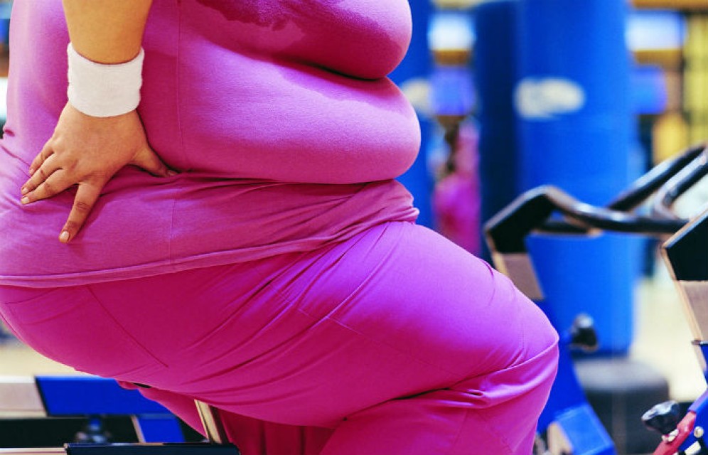 Ученые назвали основную причину развития ожирения