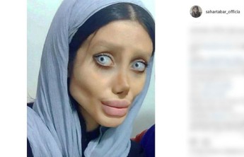 Иранка изуродовала себя ради сходства с Анджелиной Джоли