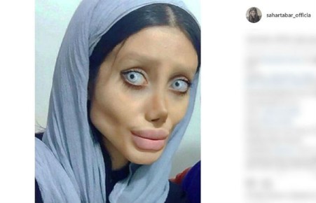 Иранка изуродовала себя ради сходства с Анджелиной Джоли