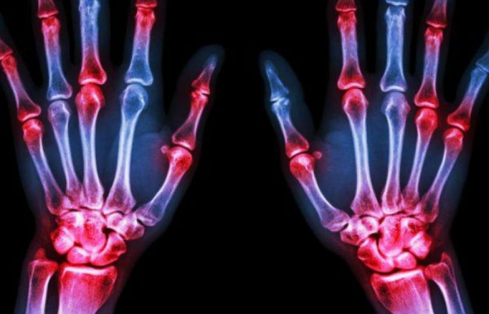 Ученые смогли впервые получить трехмерные цветные рентгеновские снимки